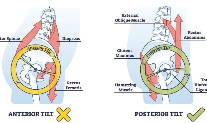 Anterior pelvic tilt exercise