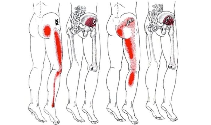 Piriformis Sciatica Stretches